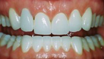 Anna K. Choe DDS-Pasadena Dentist-2-ba-b