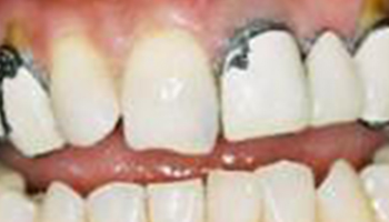 Anna K. Choe DDS-Pasadena Dentist-3-ba-a