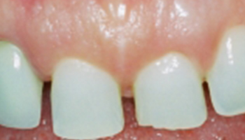Anna K. Choe DDS-Pasadena Dentist-5-ba-a
