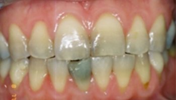Anna K. Choe DDS - Pasadena Dentist - 1- ba- a