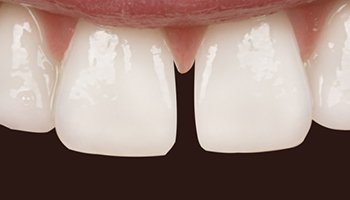 Anna K. Choe DDS-Pasadena Dentist-4-ba-a
