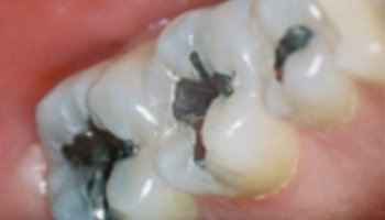 Anna K. Choe DDS-Pasadena Dentist-6-ba-a